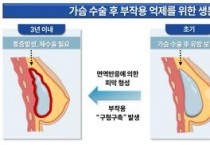 순천향대 연구팀, 오메가3 기반 생분해성 섬유로  유방보형물 부작용 ‘구형구축’ 예방 기술 개발