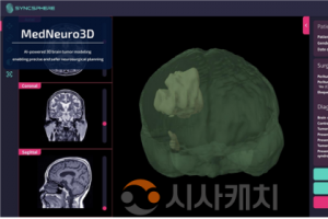 f_사진 1. ‘MedNeuro3D’ AI 기반3D 뇌 구조 모델링 후 최적 수술 경로 시뮬레이션 결과.png