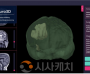 f_사진 1. ‘MedNeuro3D’ AI 기반3D 뇌 구조 모델링 후 최적 수술 경로 시뮬레이션 결과.png
